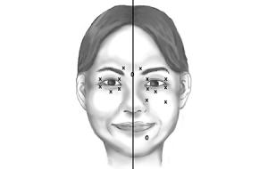 پاسخ به سوالات رایج و پرتکرار درباره‌ تزریق بوتاکس