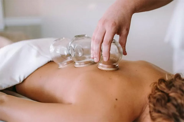 کاپینگ یا بادکش چیست و چه مزایای دارد